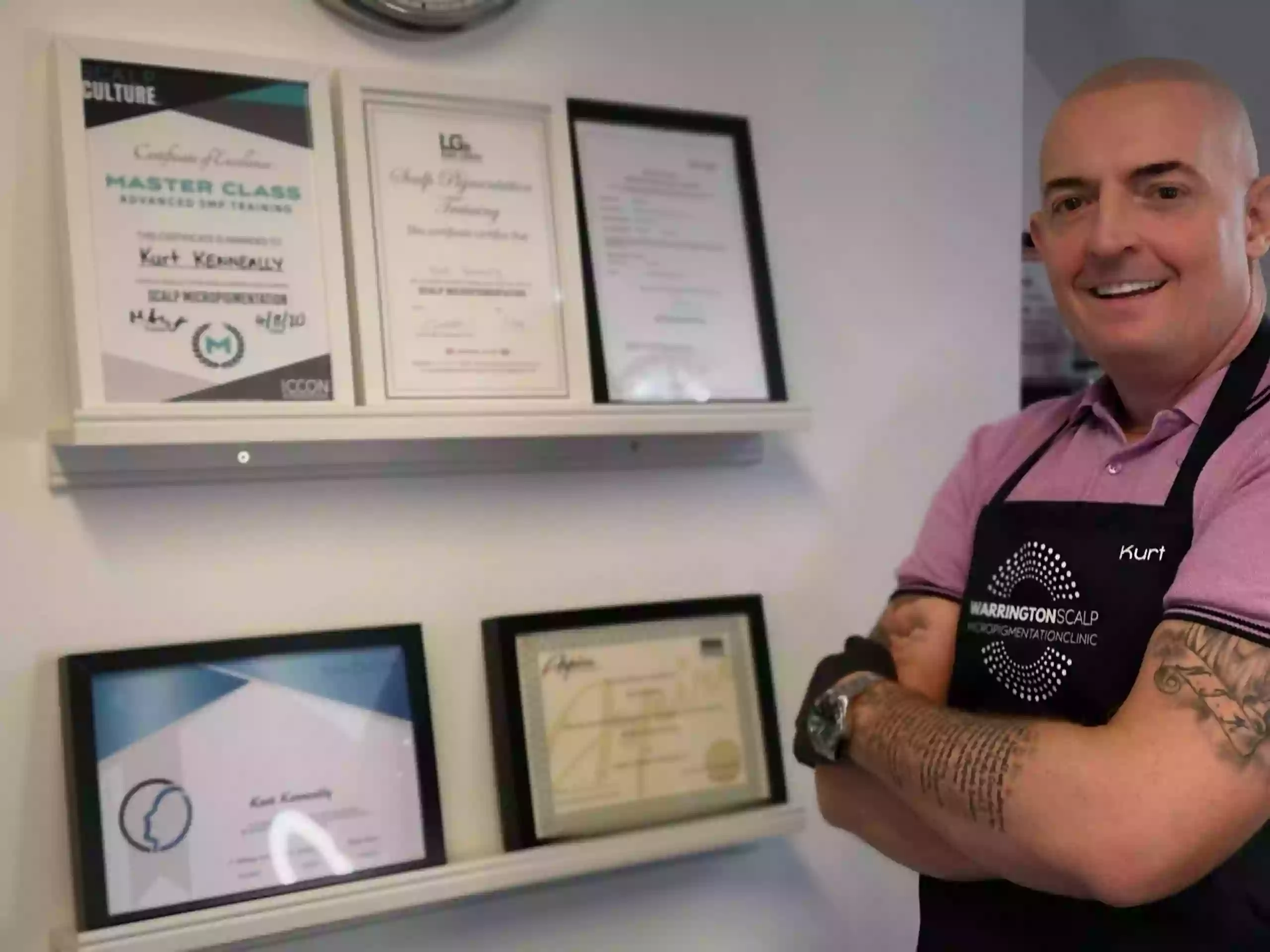 Warrington Scalp Micropigmentation Clinic