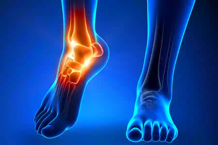 Yorkshire Sports Podiatry & Gait Clinic Sheffield