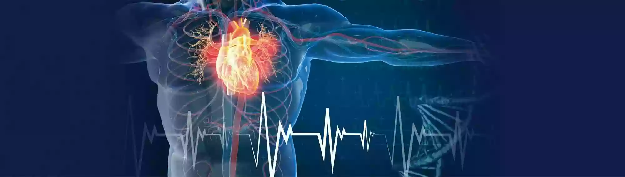 Atrial Fibrillation Institute - North Lakes