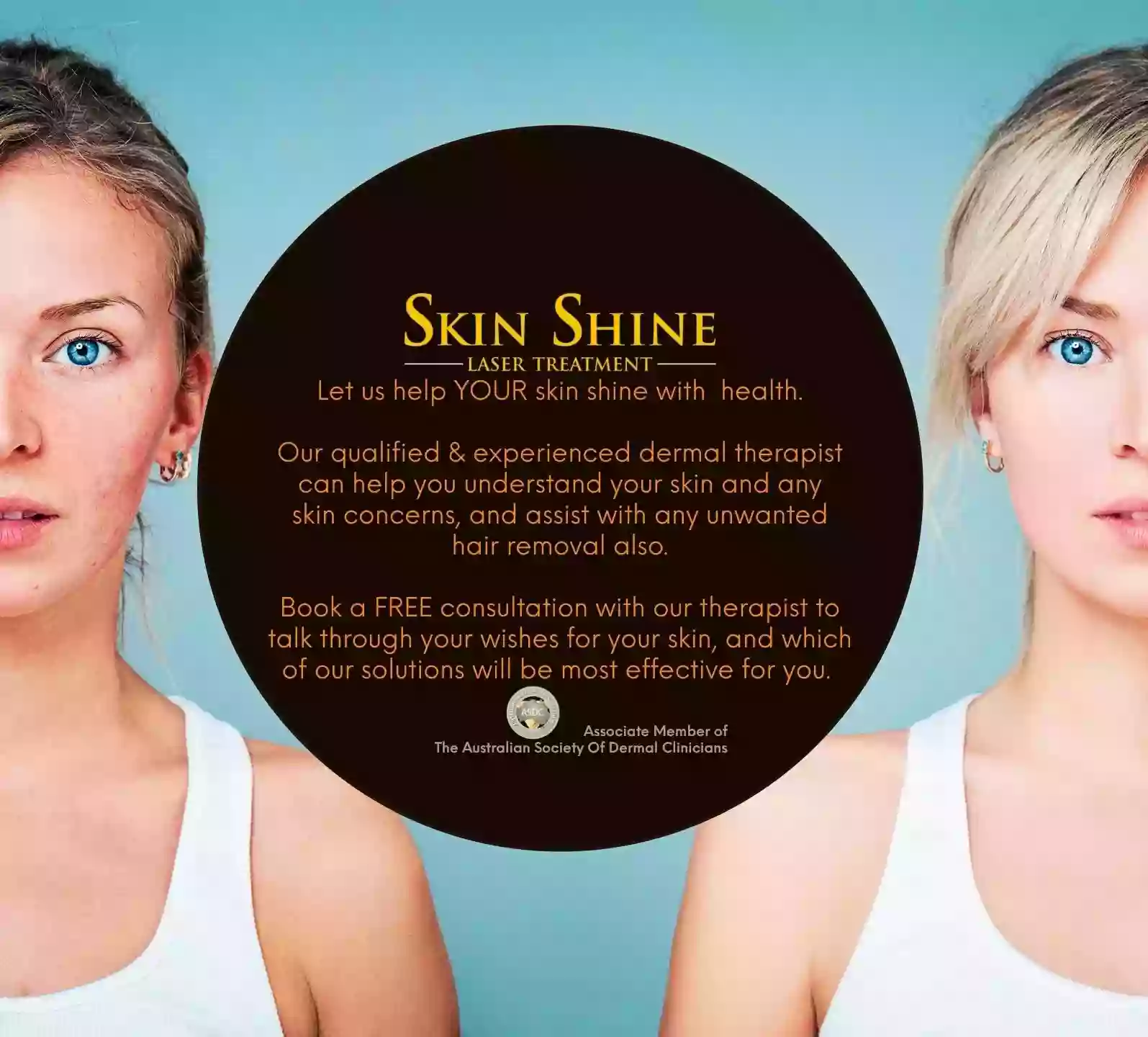 Skin Shine Laser Treatment