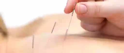 Peel Back Care Clinic - Dry Needling & Remedial Massage