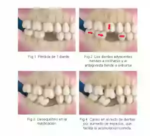 Clínica Dental Suiza. Estética dental, Implantología, Periodoncia , Odontopediatra y Ortodoncia