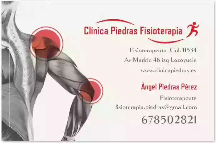 Clinica Piedras Fisioterapia