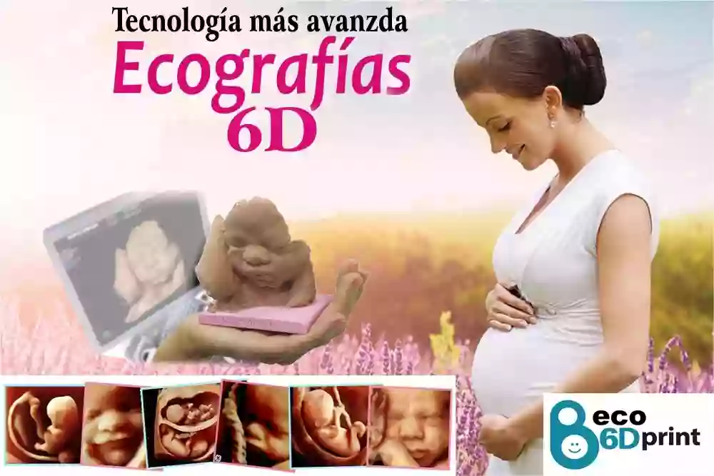 ECOGRAFIA 6D clinica euskalduna Bilbo